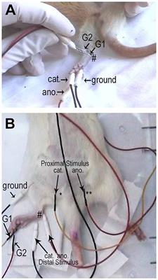 Sensory and Motor Conduction Velocity in Spontaneously Hypertensive Rats: Sex and Aging Investigation